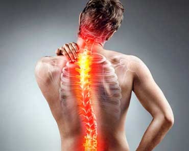 3 formas naturales para prevenir y aliviar el dolor de espalda