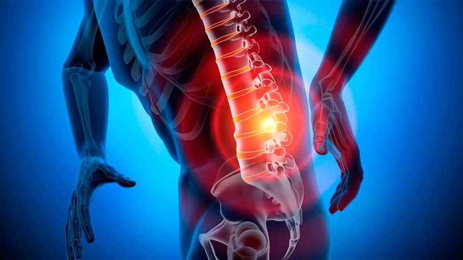 3 formas naturales para prevenir y aliviar el dolor de espalda Imagen 2